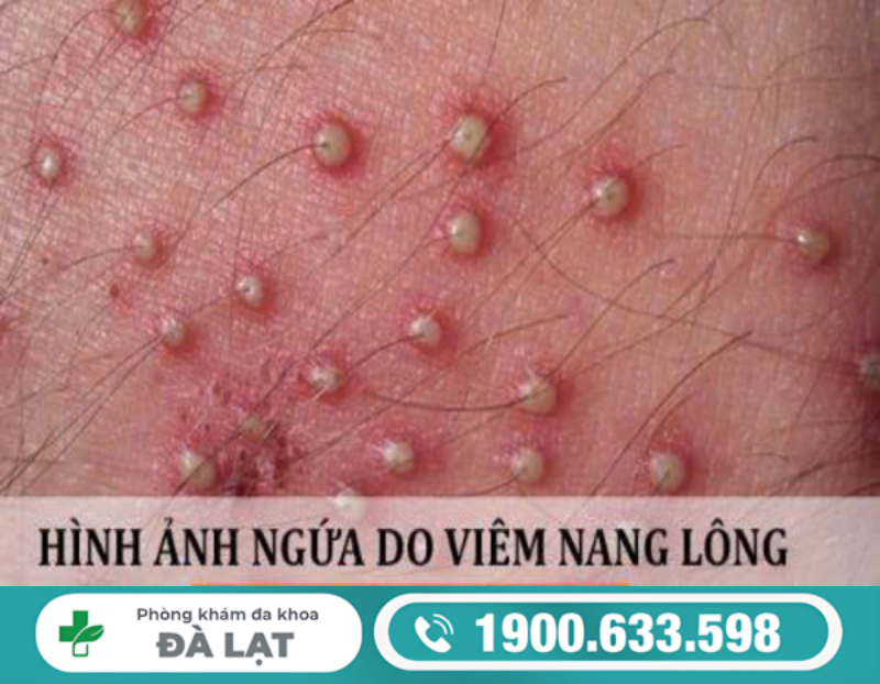 Hình ảnh minh họa